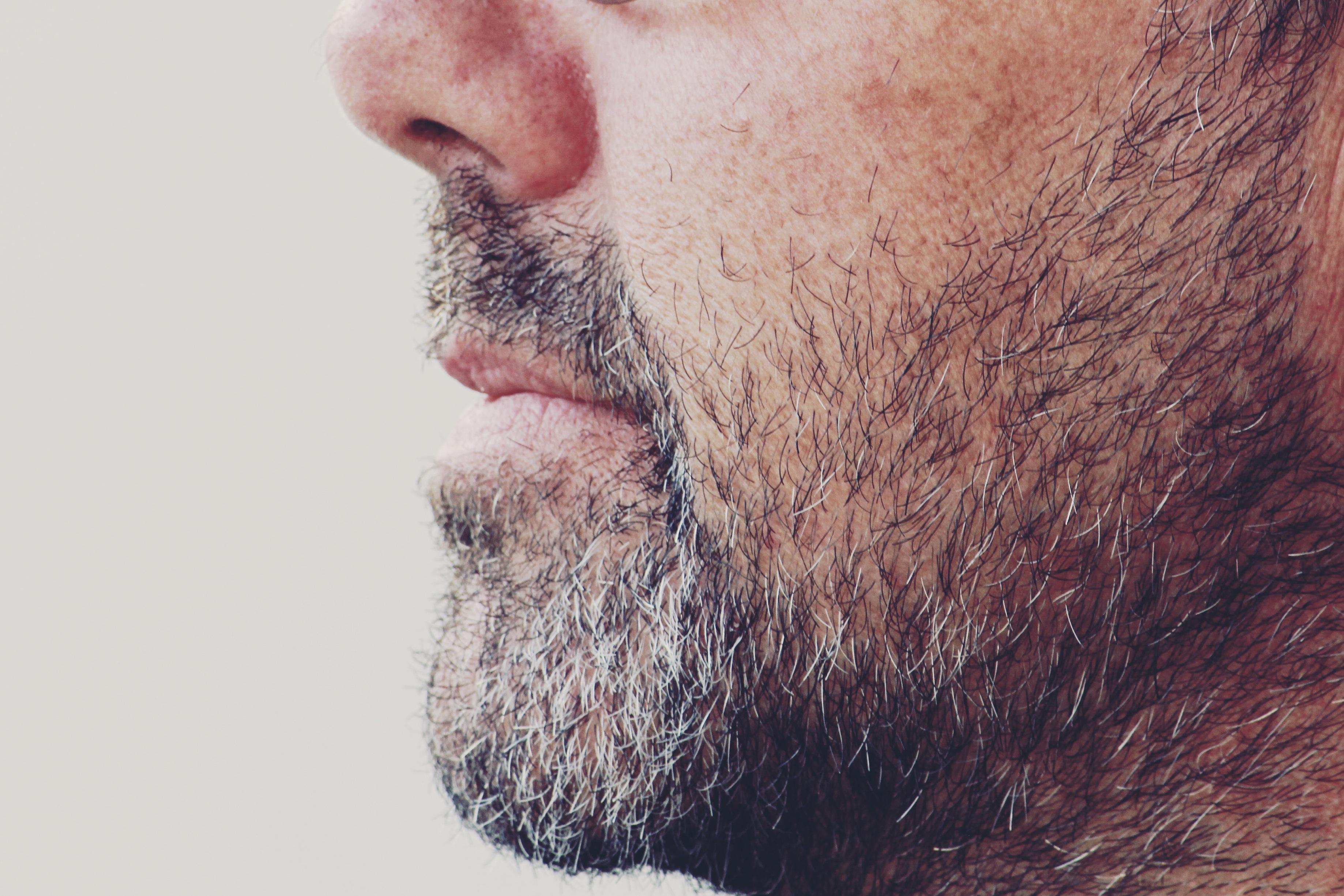 barbe greffe capillaire
